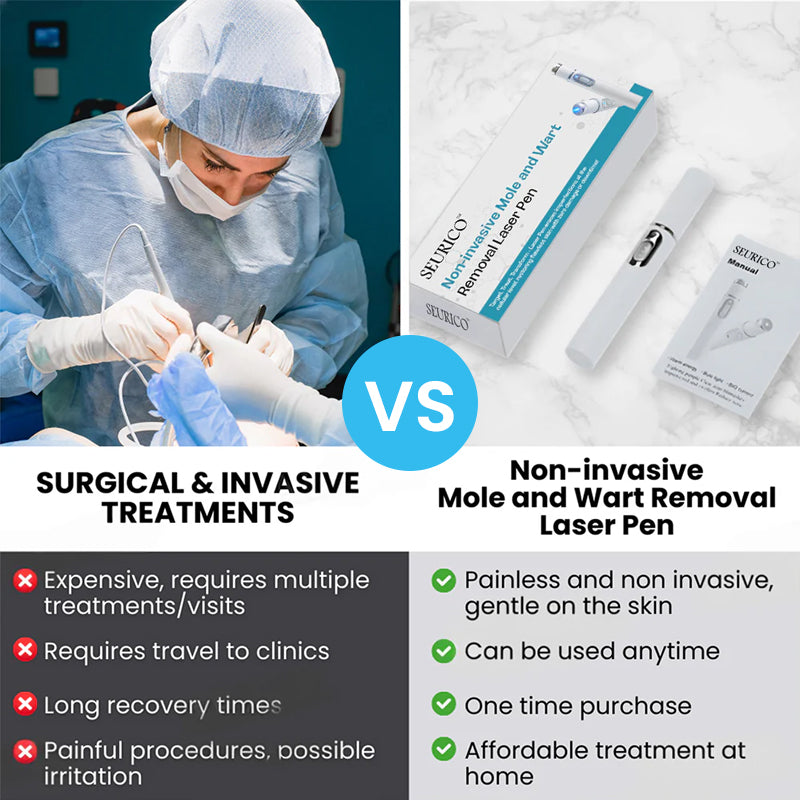 Non-Invasive Mole and Wart Removal Laser Pen