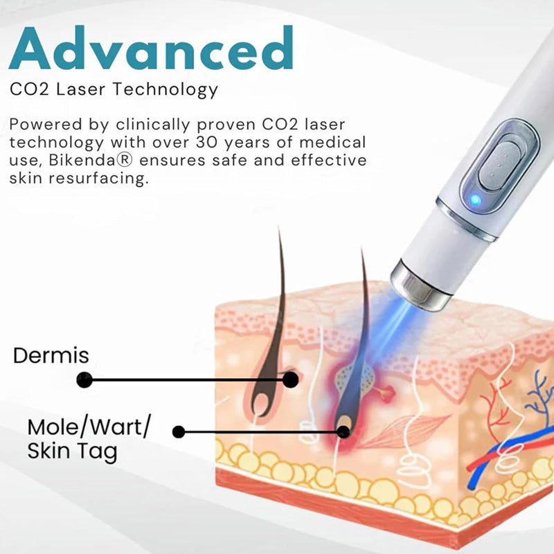 Non-Invasive Mole and Wart Removal Laser Pen