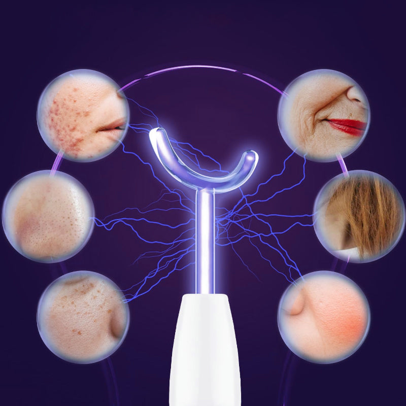 High-Frequency Energy Beauty Wand