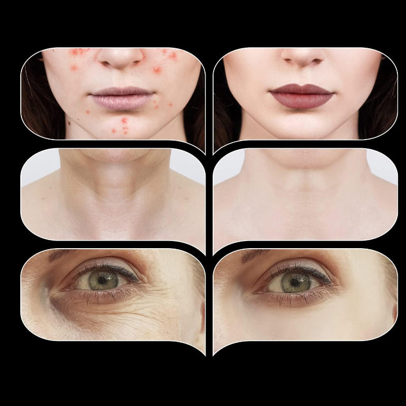 High-Frequency Energy Beauty Wand
