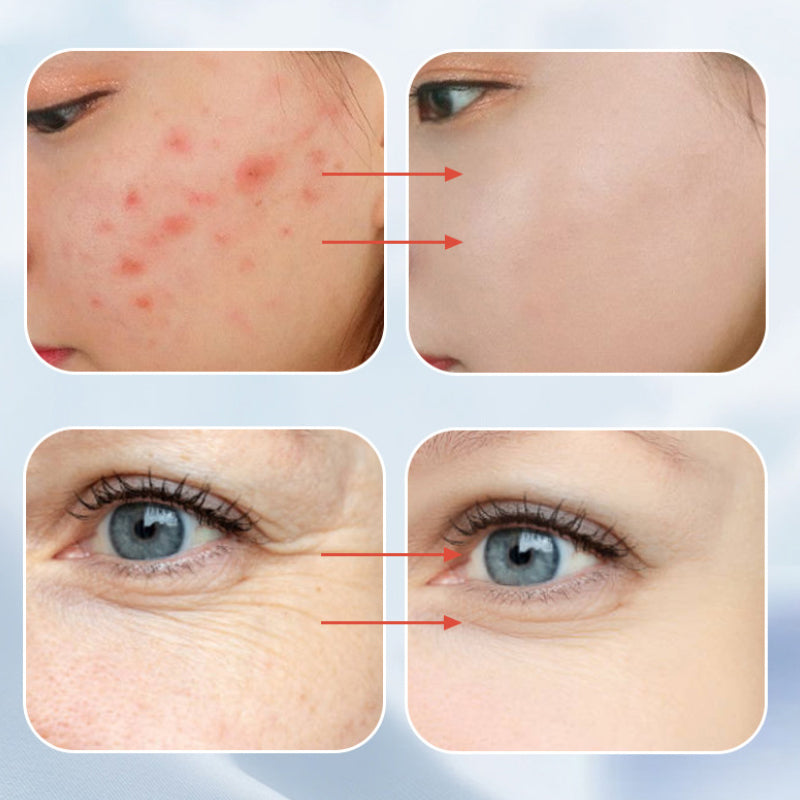 High-Frequency Energy Beauty Wand