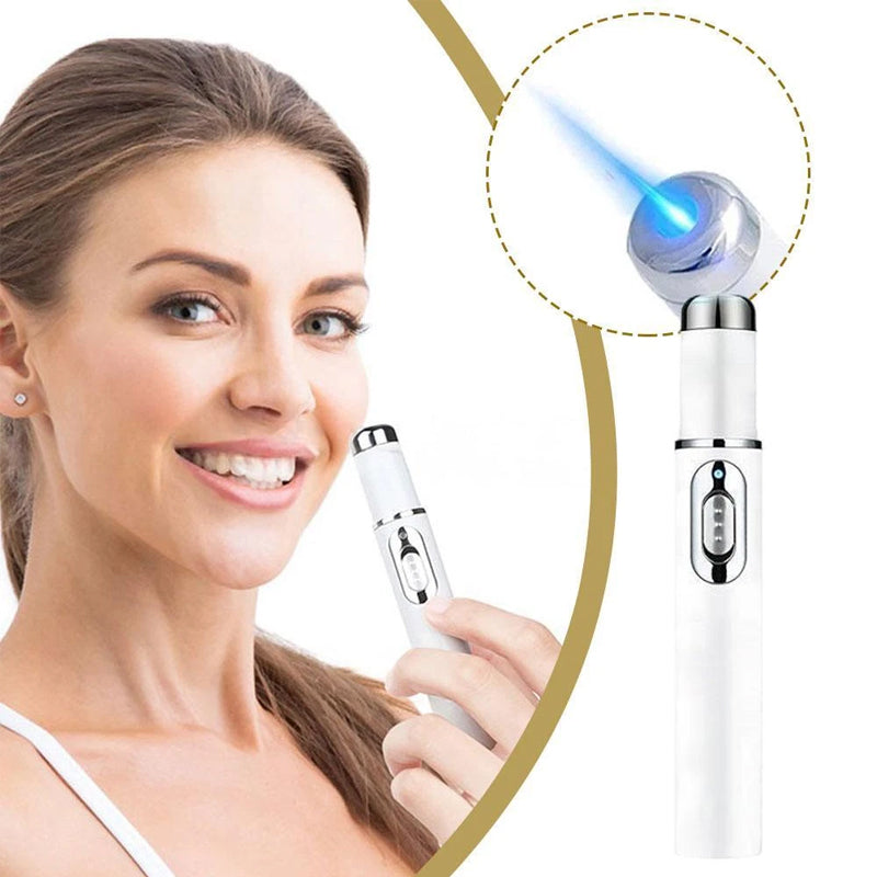 Non-Invasive Mole and Wart Removal Laser Pen