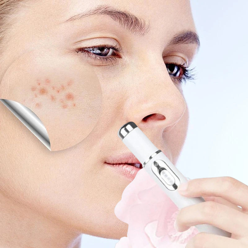 Non-Invasive Mole and Wart Removal Laser Pen