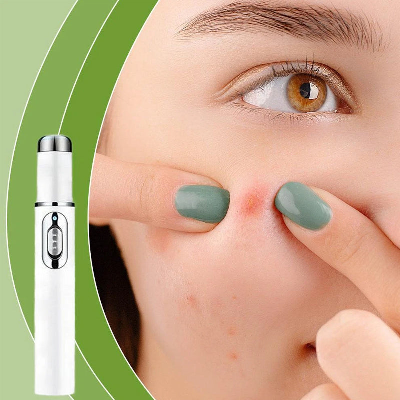 Non-Invasive Mole and Wart Removal Laser Pen